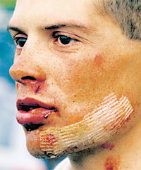 Jan ganz verletzt.jpg